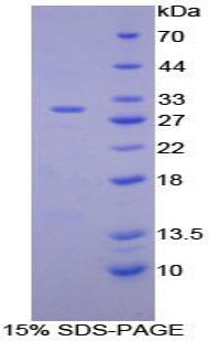 Figure 1. SDS-PAGE