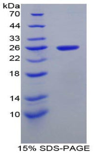 Figure 1. SDS-PAGE