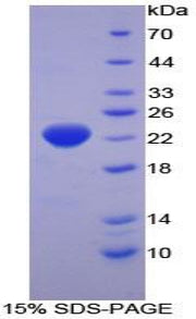 Figure 1. SDS-PAGE