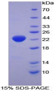 Figure 1. SDS-PAGE