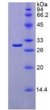 Figure 2. SDS-PAGE