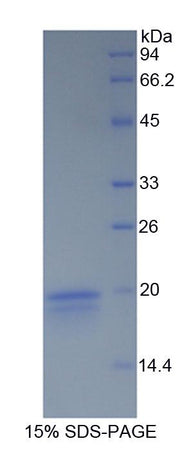 Figure 1. SDS-PAGE