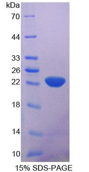 Figure 1. SDS-PAGE