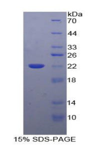 Figure 1. SDS-PAGE