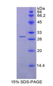 Figure 1. SDS-PAGE