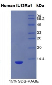 Figure 1. SDS-PAGE
