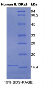 Figure 1. SDS-PAGE
