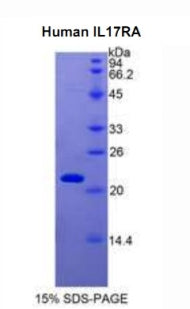 Figure 1. SDS-PAGE