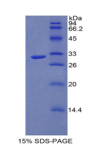 Figure 1. SDS-PAGE