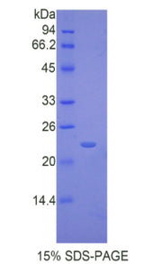Figure 1. SDS-PAGE