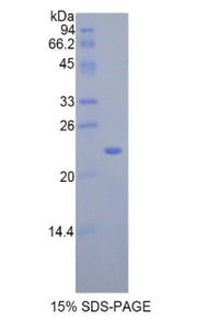 Figure 1. SDS-PAGE