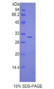 Figure 1. SDS-PAGE