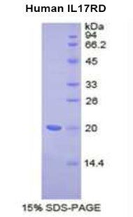 Figure 1. SDS-PAGE