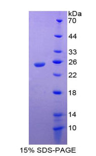 Figure 1. SDS-PAGE