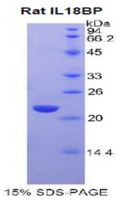 Figure 1. SDS-PAGE