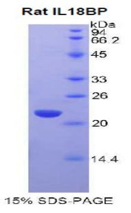 Figure 1. SDS-PAGE