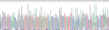 Recombinant Human Interleukin 2 (IL2)