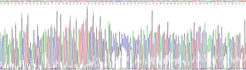 Recombinant Human Interleukin 3 Receptor Alpha (IL3Ra)