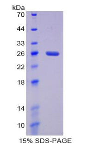 Figure 1. SDS-PAGE