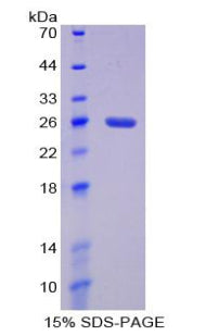 Figure 1. SDS-PAGE