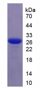Figure 1. SDS-PAGE
