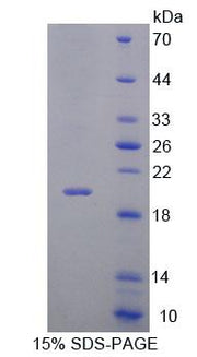 Figure 1. SDS-PAGE