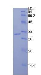 Figure 2. SDS-PAGE
