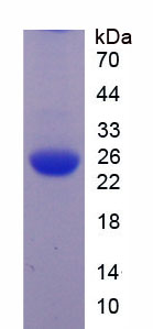 Figure 1. SDS-PAGE