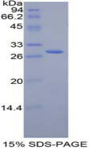 Figure 1. SDS-PAGE