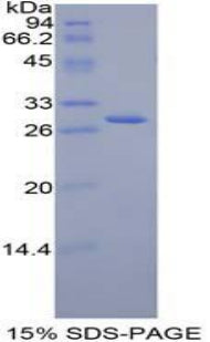 Figure 1. SDS-PAGE