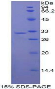 Figure 1. SDS-PAGE