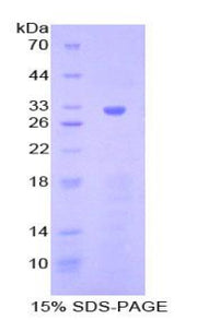 Figure 1. SDS-PAGE