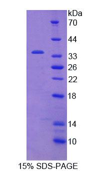 Figure 1. SDS-PAGE
