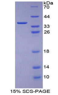 Figure 1. SDS-PAGE