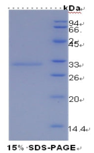 Figure 1. SDS-PAGE