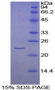 Figure 1. SDS-PAGE
