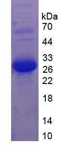 Figure 3. SDS-PAGE