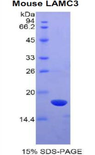 Figure 1. SDS-PAGE