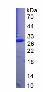 Figure 1. SDS-PAGE