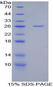 Figure 1. SDS-PAGE