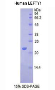 Figure 1. SDS-PAGE