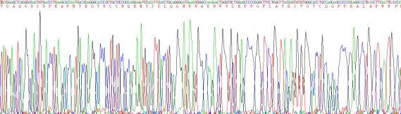 Recombinant Human Left/Right Determination Factor 2 (LEFTY2)