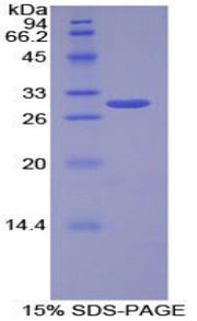 Figure 1. SDS-PAGE