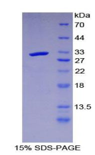 Figure 1. SDS-PAGE