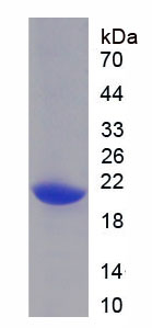 Figure 2. SDS-PAGE