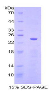 Figure 1. SDS-PAGE