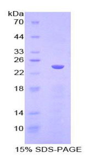 Figure 1. SDS-PAGE