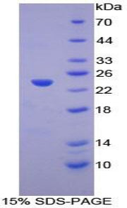 Figure 1. SDS-PAGE