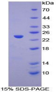 Figure 1. SDS-PAGE