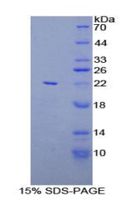 Figure 1. SDS-PAGE